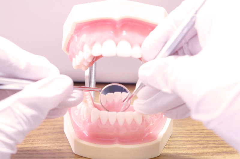 一生の笑顔と健康を守るために。痛くなる前に行く予防歯科